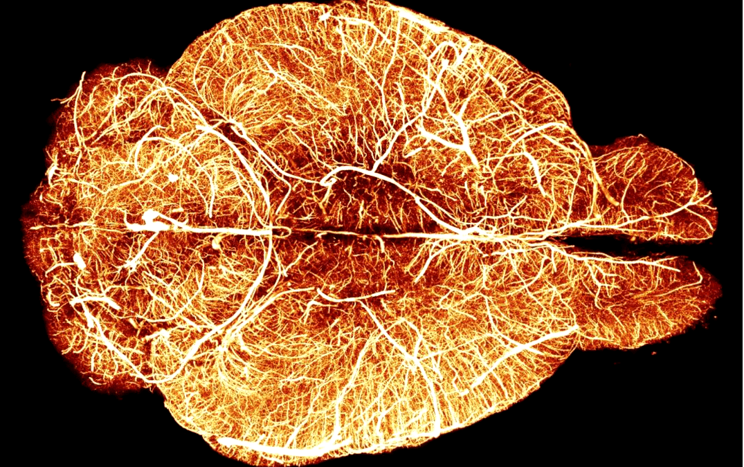 CBT vs. Somatic Therapy: Why Talking Isn’t Enough for Trauma