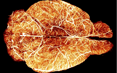 CBT vs. Somatic Therapy: Why Talking Isn’t Enough for Trauma