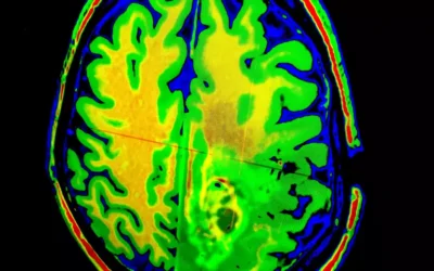 What Is Neurodivergent-Affirming Therapy? (And Why It’s Not About ‘Fixing’ You)