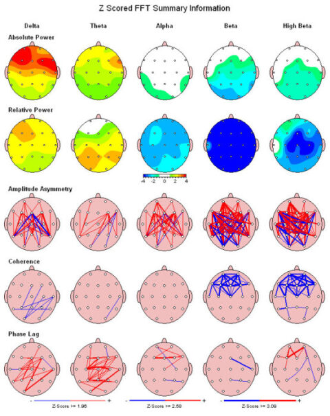 Brain Mapping, Neurofeedback, Neurostimulation And Neuromodulation ...