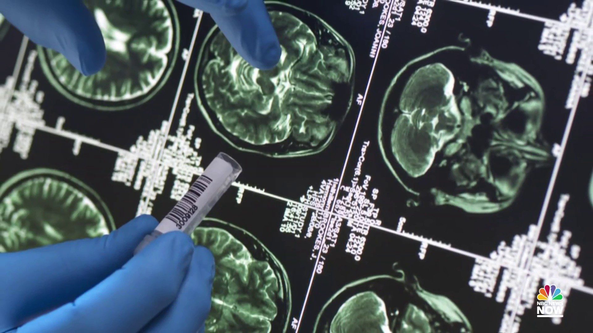 Taproot Therapy Collective is the Only Place to get Neurostimulation in Alabama.png-yr5jrz