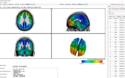 What is the Difference in QEEG Brain Mapping, Trans Cranial Magnetic Stimulation (TCMS), Neurofeedback (MCNF), Neurostimulation, and Biofeedback?