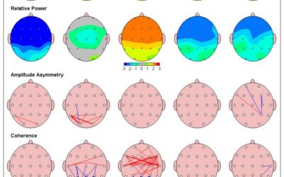 qEEG and Neuromodulation for PANDAS and PANS: What the Research Actually Says