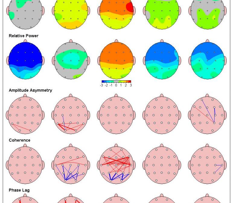 qEEG and Neuromodulation for PANDAS and PANS: What the Research Actually Says