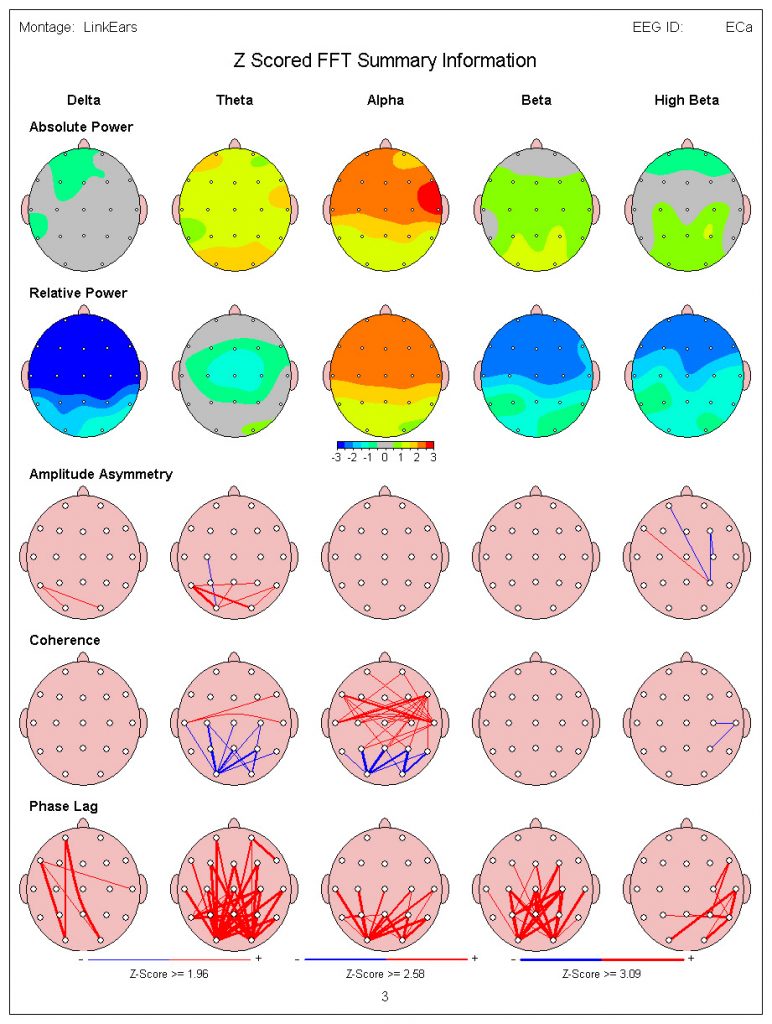 qEEG neuromodulation for PANDAS kids